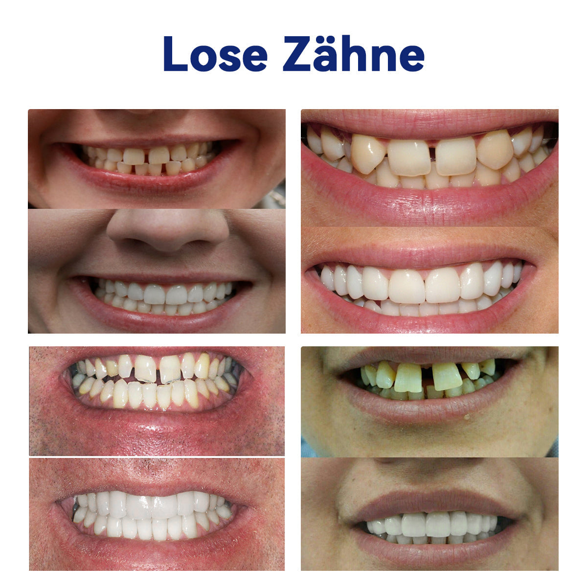 Extra 50% Rabatt!Lassen Sie sich diese Gelegenheit nicht entgehen! ๐ฅ๐ต๐๐๐๐๐๐โข ๐๐๐๐๐๐๐-๐๐โ๐๐๐๐๐กโ๐๐ ๐๐-๐
๐๐๐๐๐-๐๐๐ก