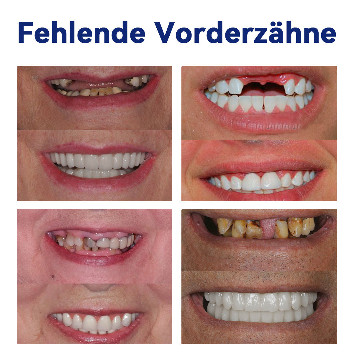 Extra 50% Rabatt!Lassen Sie sich diese Gelegenheit nicht entgehen! ๐ฅ๐ต๐๐๐๐๐๐โข ๐๐๐๐๐๐๐-๐๐โ๐๐๐๐๐กโ๐๐ ๐๐-๐
๐๐๐๐๐-๐๐๐ก