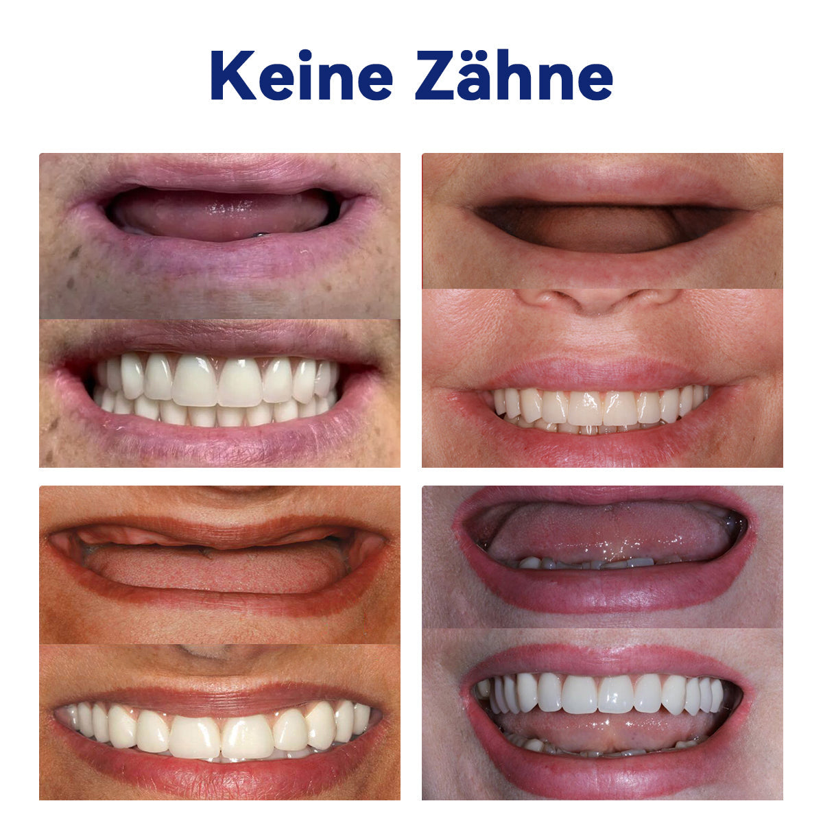 Extra 50% Rabatt!Lassen Sie sich diese Gelegenheit nicht entgehen! ๐ฅ๐ต๐๐๐๐๐๐โข ๐๐๐๐๐๐๐-๐๐โ๐๐๐๐๐กโ๐๐ ๐๐-๐
๐๐๐๐๐-๐๐๐ก