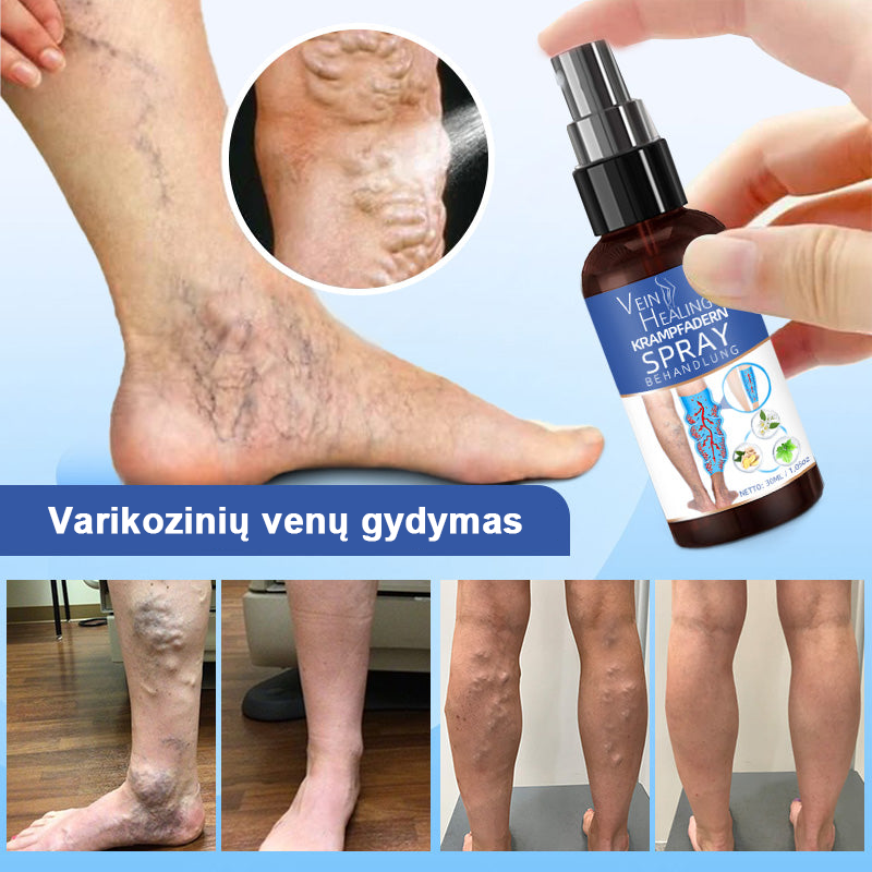 Veinhealing™ purškalas varikozinėms venoms gydyti🌱(👩‍⚕️rekomenduoja kardiologai)