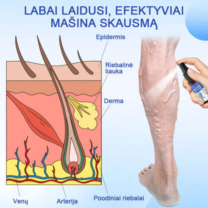 Veinhealing™ purškalas varikozinėms venoms gydyti🌱(👩‍⚕️rekomenduoja kardiologai)