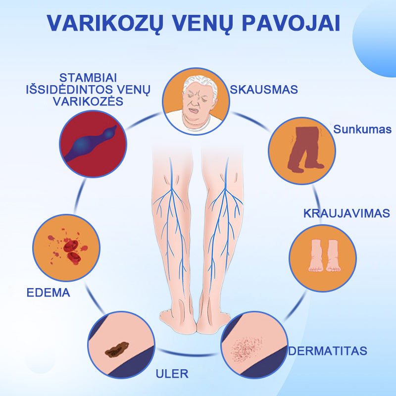 Veinhealing™ purškalas varikozinėms venoms gydyti🌱(👩‍⚕️rekomenduoja kardiologai)